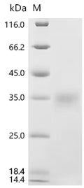 (Tris-Glycine gel) Discontinuous SDS-PAGE (reduced) with 5% enrichment gel and 15% separation gel.