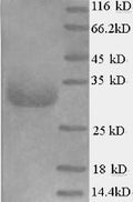 (Tris-Glycine gel) Discontinuous SDS-PAGE (reduced) with 5% enrichment gel and 15% separation gel.