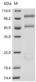 (Tris-Glycine gel) Discontinuous SDS-PAGE (reduced) with 5% enrichment gel and 15% separation gel.