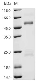 (Tris-Glycine gel) Discontinuous SDS-PAGE (reduced) with 5% enrichment gel and 15% separation gel.