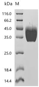(Tris-Glycine gel) Discontinuous SDS-PAGE (reduced) with 5% enrichment gel and 15% separation gel.