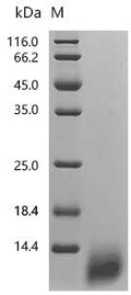 (Tris-Glycine gel) Discontinuous SDS-PAGE (reduced) with 5% enrichment gel and 15% separation gel.