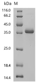 (Tris-Glycine gel) Discontinuous SDS-PAGE (reduced) with 5% enrichment gel and 15% separation gel.