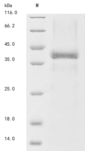 (Tris-Glycine gel) Discontinuous SDS-PAGE (reduced) with 5% enrichment gel and 15% separation gel.