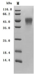 (Tris-Glycine gel) Discontinuous SDS-PAGE (reduced) with 5% enrichment gel and 15% separation gel.