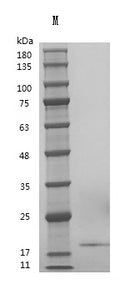Recombinant Human Fibroblast growth factor 10 (FGF10) (Active) – Figure 1 of 1