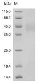 (Tris-Glycine gel) Discontinuous SDS-PAGE (reduced) with 5% enrichment gel and 15% separation gel.