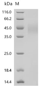 (Tris-Glycine gel) Discontinuous SDS-PAGE (reduced) with 5% enrichment gel and 15% separation gel.