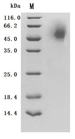 (Tris-Glycine gel) Discontinuous SDS-PAGE (reduced) with 5% enrichment gel and 15% separation gel.