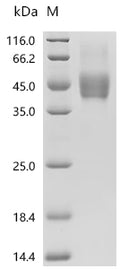 (Tris-Glycine gel) Discontinuous SDS-PAGE (reduced) with 5% enrichment gel and 15% separation gel.