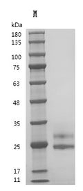 Recombinant Human Fms-related tyrosine kinase 3 ligand (FLT3LG), partial (Active) – Figure 1 of 1