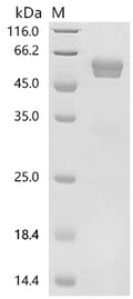 (Tris-Glycine gel) Discontinuous SDS-PAGE (reduced) with 5% enrichment gel and 15% separation gel.