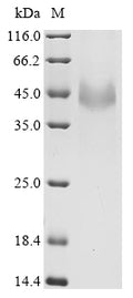 (Tris-Glycine gel) Discontinuous SDS-PAGE (reduced) with 5% enrichment gel and 15% separation gel.