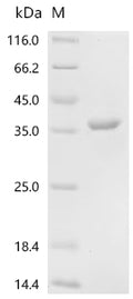 (Tris-Glycine gel) Discontinuous SDS-PAGE (reduced) with 5% enrichment gel and 15% separation gel.