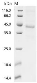 (Tris-Glycine gel) Discontinuous SDS-PAGE (reduced) with 5% enrichment gel and 15% separation gel.