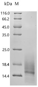(Tris-Glycine gel) Discontinuous SDS-PAGE (reduced) with 5% enrichment gel and 15% separation gel.