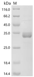 (Tris-Glycine gel) Discontinuous SDS-PAGE (reduced) with 5% enrichment gel and 15% separation gel.