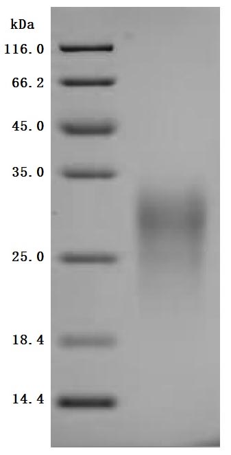 (Tris-Glycine gel) Discontinuous SDS-PAGE (reduced) with 5% enrichment gel and 15% separation gel.