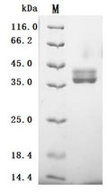 (Tris-Glycine gel) Discontinuous SDS-PAGE (reduced) with 5% enrichment gel and 15% separation gel.