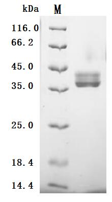 (Tris-Glycine gel) Discontinuous SDS-PAGE (reduced) with 5% enrichment gel and 15% separation gel.