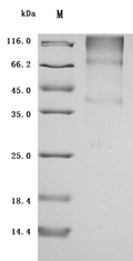 (Tris-Glycine gel) Discontinuous SDS-PAGE (reduced) with 5% enrichment gel and 15% separation gel.