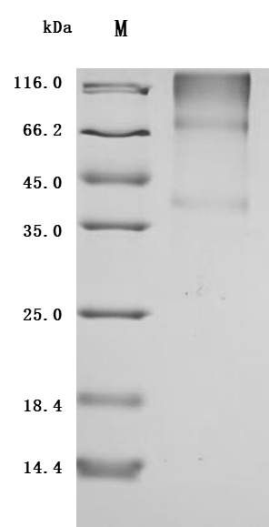 (Tris-Glycine gel) Discontinuous SDS-PAGE (reduced) with 5% enrichment gel and 15% separation gel.