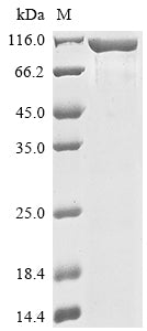 (Tris-Glycine gel) Discontinuous SDS-PAGE (reduced) with 5% enrichment gel and 15% separation gel.