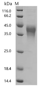 (Tris-Glycine gel) Discontinuous SDS-PAGE (reduced) with 5% enrichment gel and 15% separation gel.