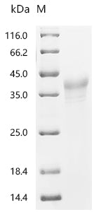 (Tris-Glycine gel) Discontinuous SDS-PAGE (reduced) with 5% enrichment gel and 15% separation gel.
