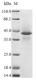 (Tris-Glycine gel) Discontinuous SDS-PAGE (reduced) with 5% enrichment gel and 15% separation gel.