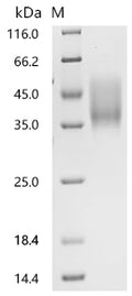 (Tris-Glycine gel) Discontinuous SDS-PAGE (reduced) with 5% enrichment gel and 15% separation gel.