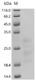 (Tris-Glycine gel) Discontinuous SDS-PAGE (reduced) with 5% enrichment gel and 15% separation gel.