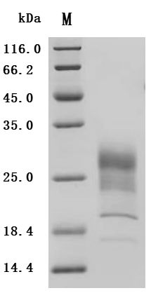 (Tris-Glycine gel) Discontinuous SDS-PAGE (reduced) with 5% enrichment gel and 15% separation gel.