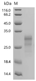 (Tris-Glycine gel) Discontinuous SDS-PAGE (reduced) with 5% enrichment gel and 15% separation gel.