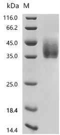 (Tris-Glycine gel) Discontinuous SDS-PAGE (reduced) with 5% enrichment gel and 15% separation gel.