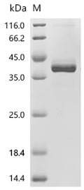 (Tris-Glycine gel) Discontinuous SDS-PAGE (reduced) with 5% enrichment gel and 15% separation gel.