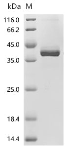 (Tris-Glycine gel) Discontinuous SDS-PAGE (reduced) with 5% enrichment gel and 15% separation gel.