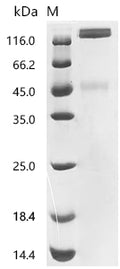 (Tris-Glycine gel) Discontinuous SDS-PAGE (reduced) with 5% enrichment gel and 15% separation gel.