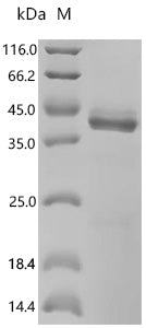 (Tris-Glycine gel) Discontinuous SDS-PAGE (reduced) with 5% enrichment gel and 15% separation gel.