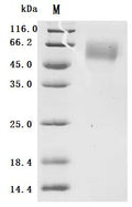 (Tris-Glycine gel) Discontinuous SDS-PAGE (reduced) with 5% enrichment gel and 15% separation gel.