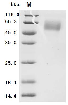 (Tris-Glycine gel) Discontinuous SDS-PAGE (reduced) with 5% enrichment gel and 15% separation gel.