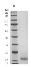 Recombinant Human Interleukin-15 (IL15) (Active) – Figure 1 of 1