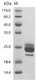 (Tris-Glycine gel) Discontinuous SDS-PAGE (reduced) with 5% enrichment gel and 15% separation gel.