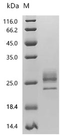 (Tris-Glycine gel) Discontinuous SDS-PAGE (reduced) with 5% enrichment gel and 15% separation gel.