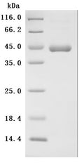 (Tris-Glycine gel) Discontinuous SDS-PAGE (reduced) with 5% enrichment gel and 15% separation gel.