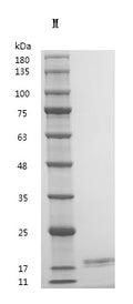 Recombinant Human Interleukin-2 (IL2) (Active) – Figure 1 of 1