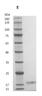 Recombinant Human Interleukin-2 (IL2) (Active) – Figure 1 of 1