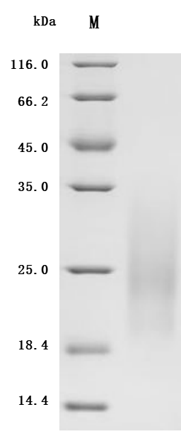 (Tris-Glycine gel) Discontinuous SDS-PAGE (reduced) with 5% enrichment gel and 15% separation gel.