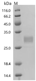 (Tris-Glycine gel) Discontinuous SDS-PAGE (reduced) with 5% enrichment gel and 15% separation gel.