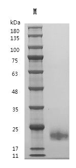 Recombinant Human Interleukin-4 (IL4) (Active) – Figure 1 of 1